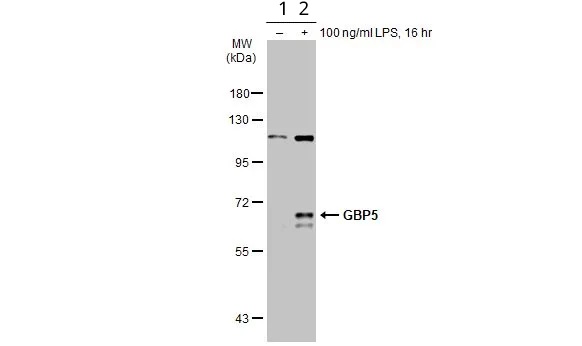 Western blot - Anti-GBP5 antibody (AB96119)