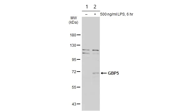 Western blot - Anti-GBP5 antibody (AB96119)