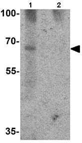 Western blot - Anti-GBP5 antibody - C-terminal (AB167085)