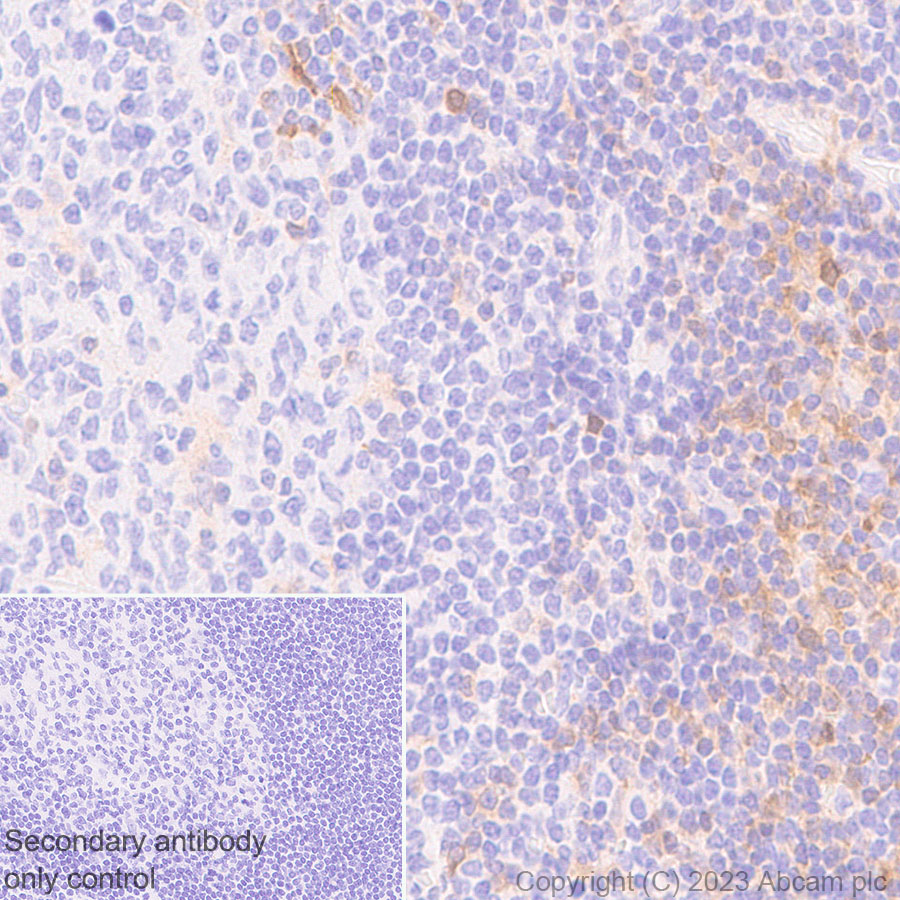 Immunohistochemistry (Formalin/PFA-fixed paraffin-embedded sections) - Anti-GBP5 antibody [EPR28367-83] - BSA and Azide free (ab313391), expandable thumbnail