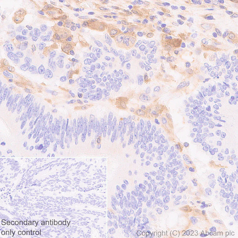 Immunohistochemistry (Formalin/PFA-fixed paraffin-embedded sections) - Anti-GBP5 antibody [EPR28367-83] - BSA and Azide free (AB313391)