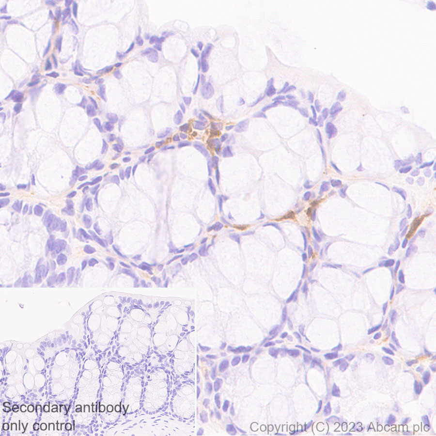 Immunohistochemistry (Formalin/PFA-fixed paraffin-embedded sections) - Anti-GBP5 antibody [EPR28367-83] - BSA and Azide free (ab313391), expandable thumbnail
