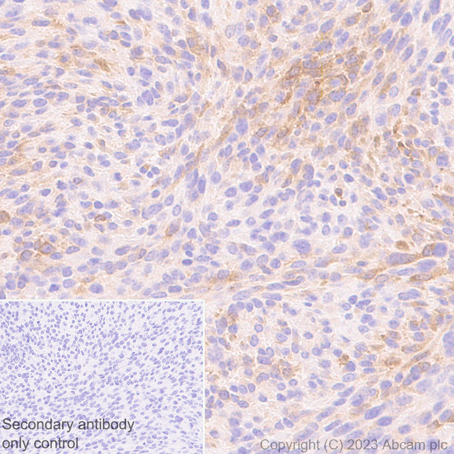 Immunohistochemistry (Formalin/PFA-fixed paraffin-embedded sections) - Anti-GBP5 antibody [EPR28367-83] - BSA and Azide free (ab313391), expandable thumbnail