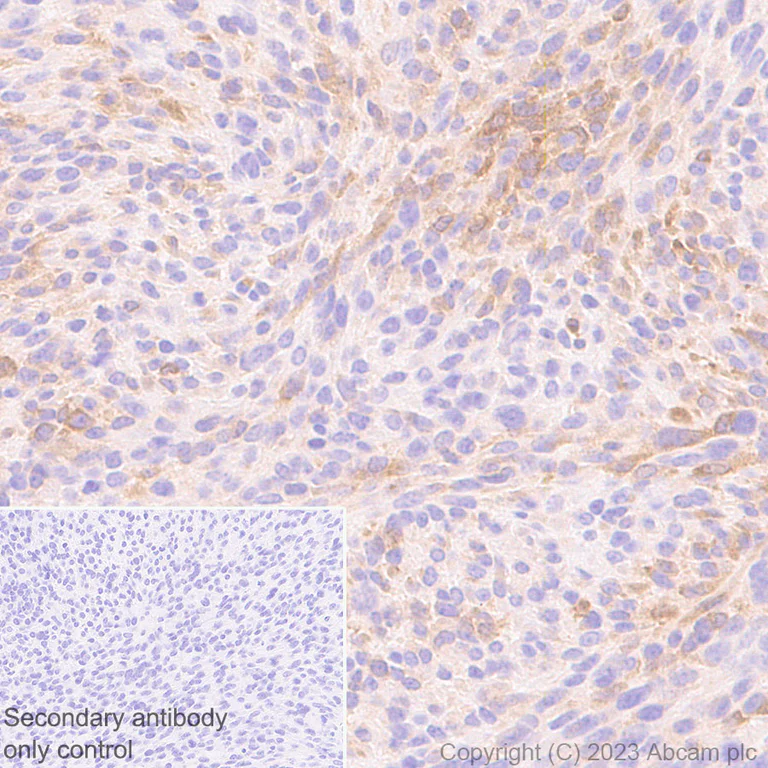 Immunohistochemistry (Formalin/PFA-fixed paraffin-embedded sections) - Anti-GBP5 antibody [EPR28367-83] - BSA and Azide free (AB313391)