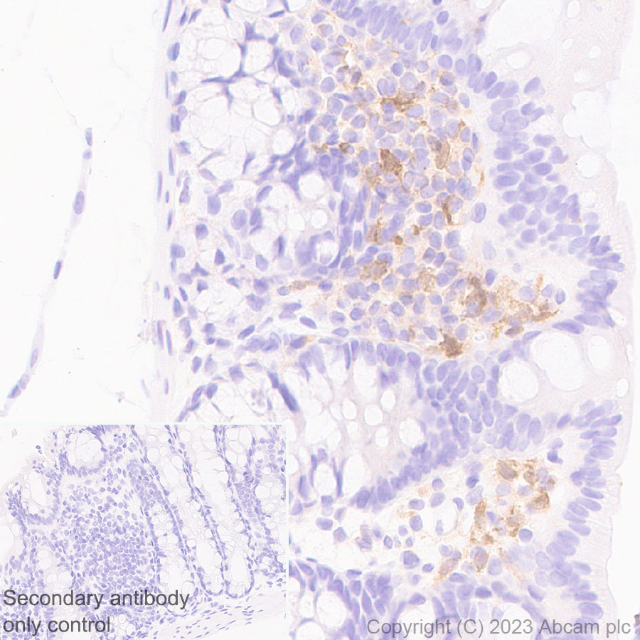 Immunohistochemistry (Formalin/PFA-fixed paraffin-embedded sections) - Anti-GBP5 antibody [EPR28367-83] - BSA and Azide free (ab313391), expandable thumbnail