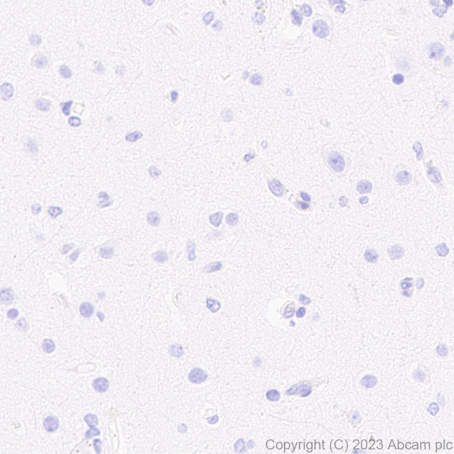 Immunohistochemistry (Formalin/PFA-fixed paraffin-embedded sections) - Anti-GBP5 antibody [EPR28367-83] - BSA and Azide free (ab313391), expandable thumbnail