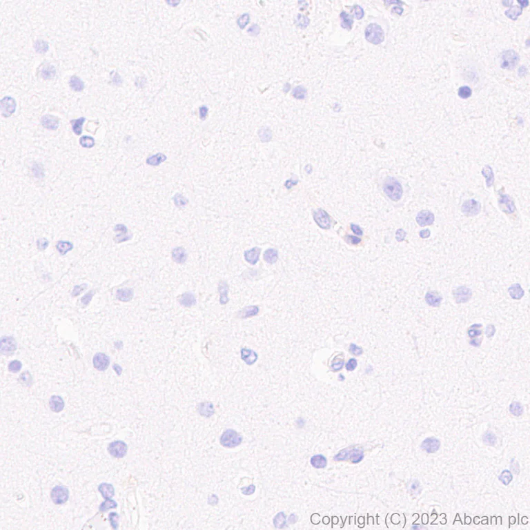 Immunohistochemistry (Formalin/PFA-fixed paraffin-embedded sections) - Anti-GBP5 antibody [EPR28367-83] - BSA and Azide free (AB313391)