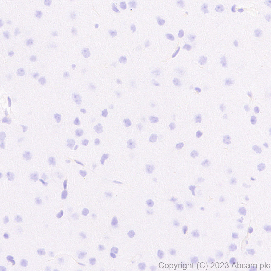 Immunohistochemistry (Formalin/PFA-fixed paraffin-embedded sections) - Anti-GBP5 antibody [EPR28367-83] - BSA and Azide free (ab313391), expandable thumbnail
