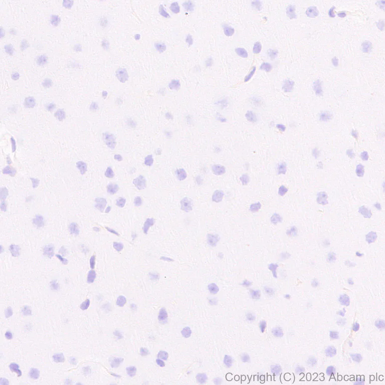 Immunohistochemistry (Formalin/PFA-fixed paraffin-embedded sections) - Anti-GBP5 antibody [EPR28367-83] - BSA and Azide free (AB313391)