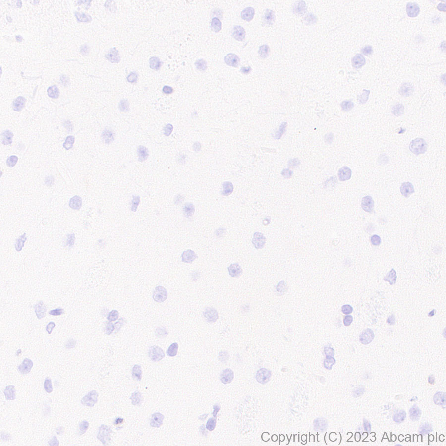 Immunohistochemistry (Formalin/PFA-fixed paraffin-embedded sections) - Anti-GBP5 antibody [EPR28367-83] - BSA and Azide free (ab313391), expandable thumbnail