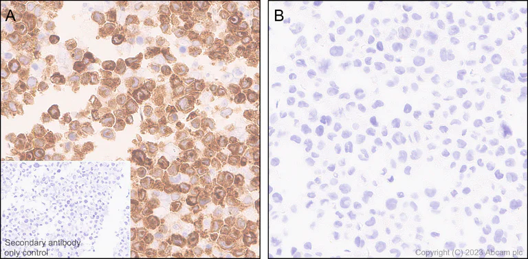 Immunohistochemistry (Formalin/PFA-fixed paraffin-embedded sections) - Anti-GBP5 antibody [EPR28367-83] - BSA and Azide free (AB313391)