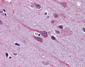 Immunohistochemistry (Formalin/PFA-fixed paraffin-embedded sections) - Anti-Gbx2 antibody (AB109726), expandable thumbnail
