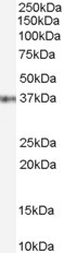 Western blot - Anti-Gbx2 antibody (AB109726), expandable thumbnail