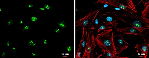Immunocytochemistry/ Immunofluorescence - Anti-Gbx2 antibody (AB227853)