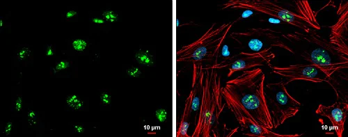 Immunocytochemistry/ Immunofluorescence - Anti-Gbx2 antibody (AB227853)