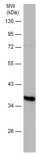 Western blot - Anti-Gbx2 antibody (AB227853)