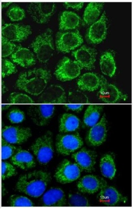 Immunocytochemistry/ Immunofluorescence - Anti-GC-1 antibody (AB137614)