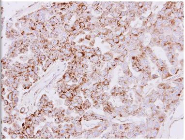 Immunohistochemistry (Formalin/PFA-fixed paraffin-embedded sections) - Anti-GC-1 antibody (AB137614)