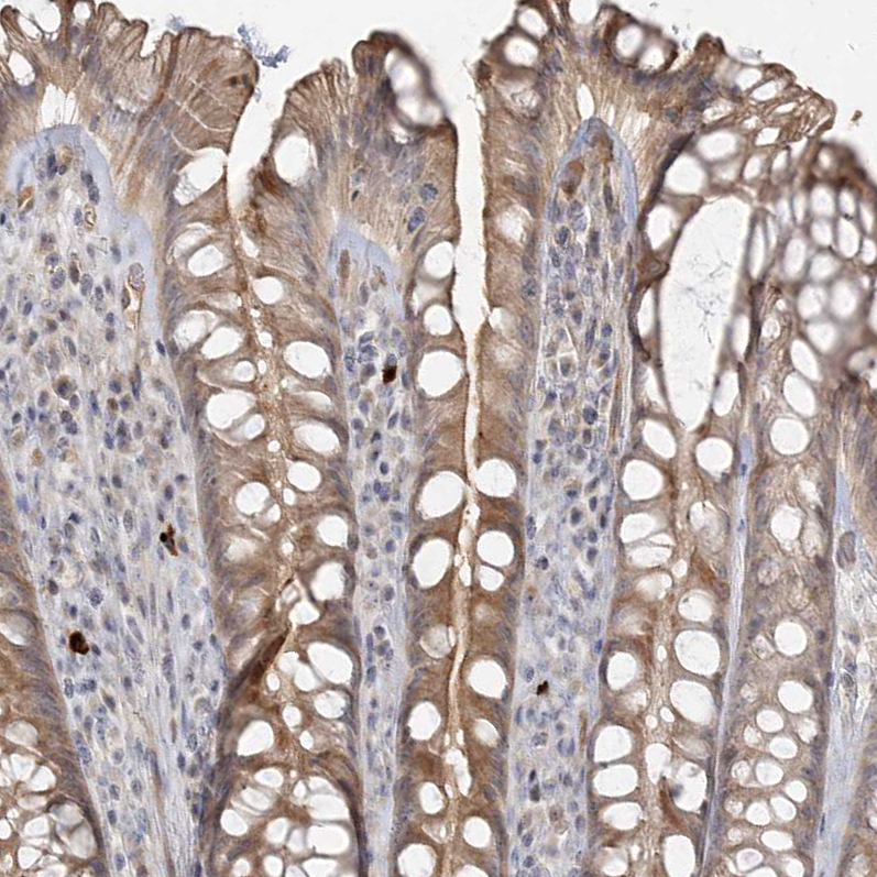 Immunohistochemistry (Formalin/PFA-fixed paraffin-embedded sections) - Anti-GC-C antibody (AB122404), expandable thumbnail