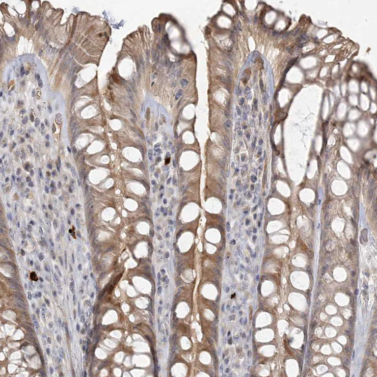 Immunohistochemistry (Formalin/PFA-fixed paraffin-embedded sections) - Anti-GC-C antibody (AB122404)