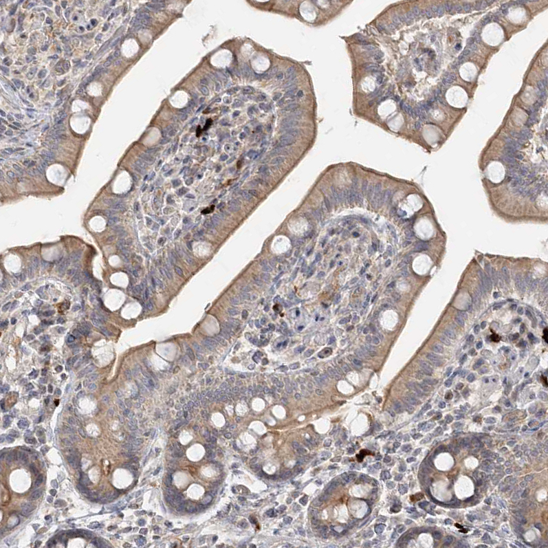 Immunohistochemistry (Formalin/PFA-fixed paraffin-embedded sections) - Anti-GC-C antibody (AB122404), expandable thumbnail