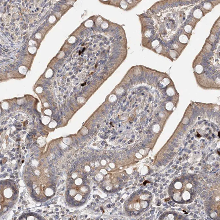 Immunohistochemistry (Formalin/PFA-fixed paraffin-embedded sections) - Anti-GC-C antibody (AB122404)