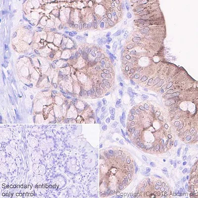 Immunohistochemistry (Formalin/PFA-fixed paraffin-embedded sections) - Anti-GC-C antibody [EPR22056-278] (AB225864)