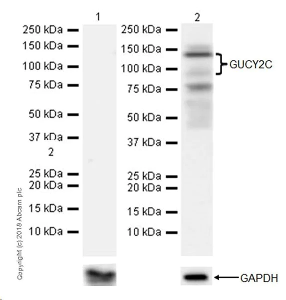 Western blot - Anti-GC-C antibody [EPR22056-278] (AB225864)