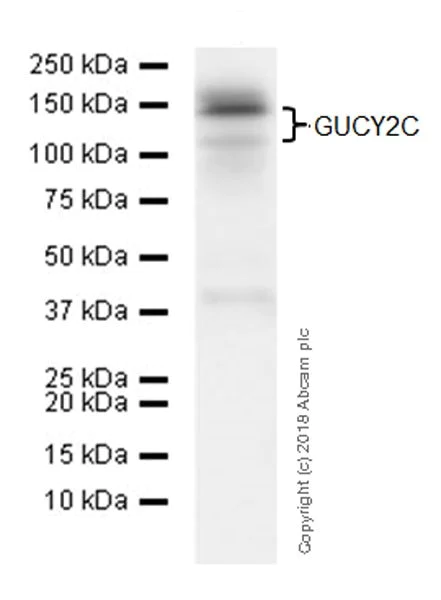 Western blot - Anti-GC-C antibody [EPR22056-278] (AB225864)