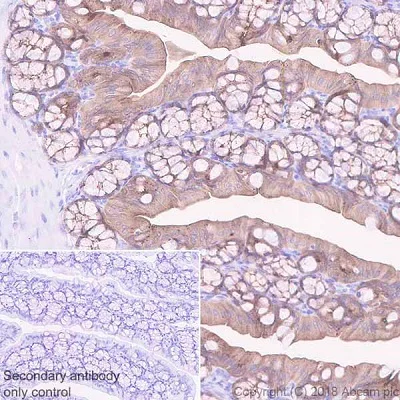 Immunohistochemistry (Formalin/PFA-fixed paraffin-embedded sections) - Anti-GC-C antibody [EPR22056-278] - BSA and Azide free (AB237602)