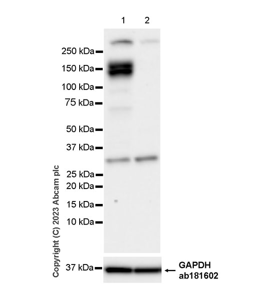 Western blot - Anti-GC-C antibody [EPR26427-38] (AB314309), expandable thumbnail