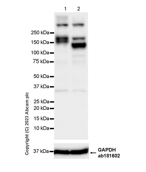 Western blot - Anti-GC-C antibody [EPR26427-38] (AB314309), expandable thumbnail