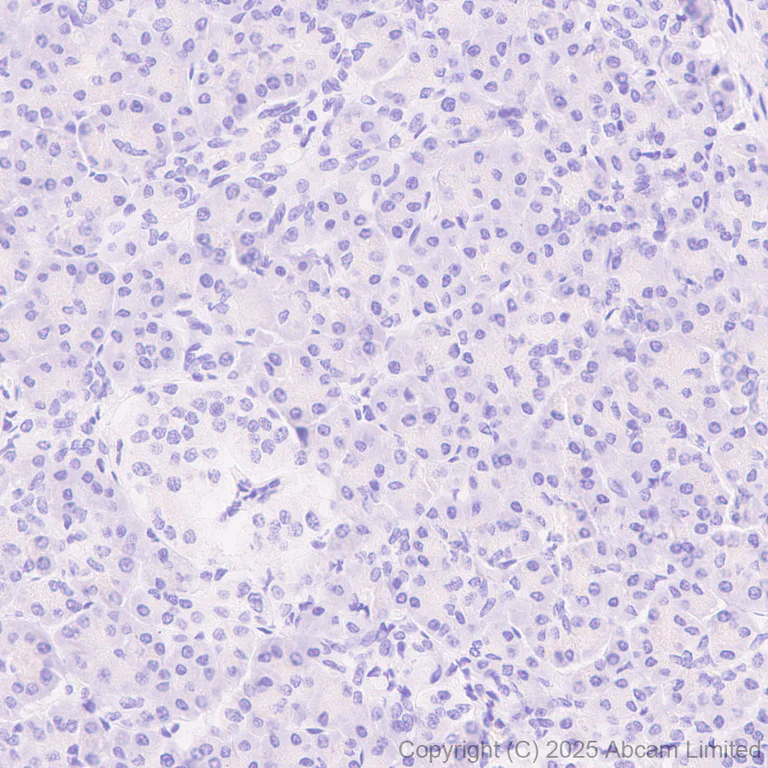 Immunohistochemistry (Formalin/PFA-fixed paraffin-embedded sections) - Anti-GC-C antibody [EPR29752-507] (AB323804)