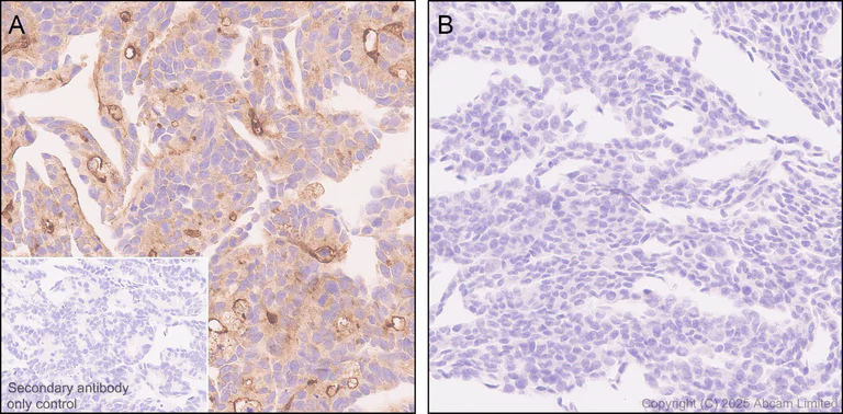 Immunohistochemistry (Formalin/PFA-fixed paraffin-embedded sections) - Anti-GC-C antibody [EPR29752-507] (AB323804)