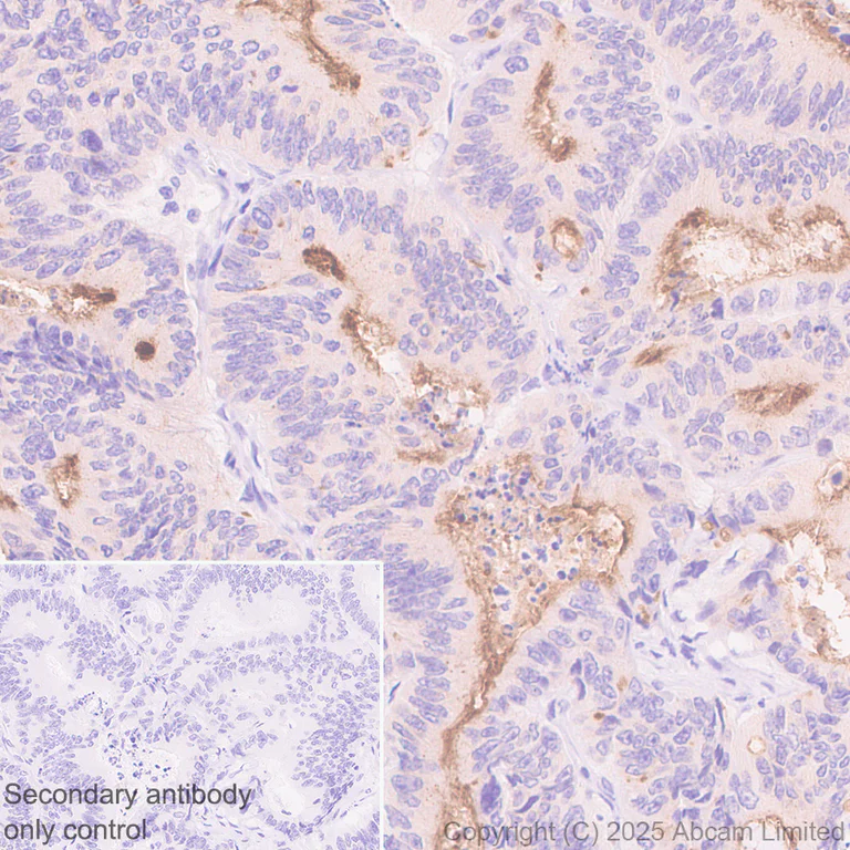 Immunohistochemistry (Formalin/PFA-fixed paraffin-embedded sections) - Anti-GC-C antibody [EPR29752-507] - BSA and Azide free (AB323813)