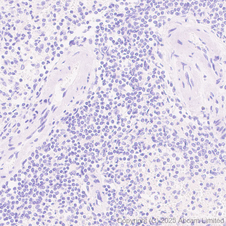 Immunohistochemistry (Formalin/PFA-fixed paraffin-embedded sections) - Anti-GC-C antibody [EPR29752-507] - BSA and Azide free (AB323813)