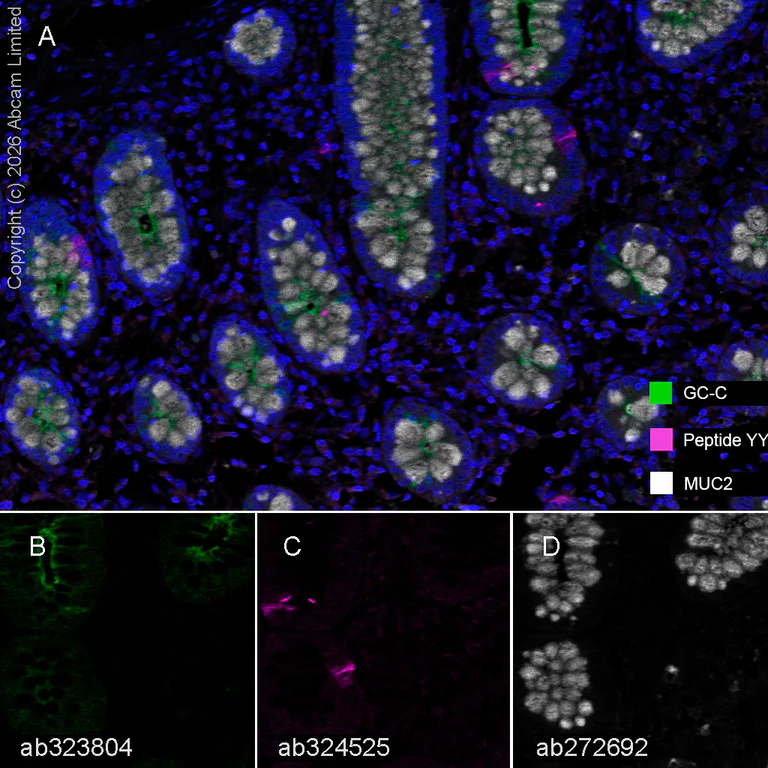 Multiplex immunohistochemistry - Anti-GC-C antibody [EPR29752-507] - BSA and Azide free (AB323813)
