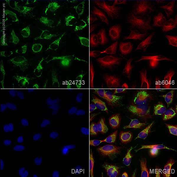 Immunocytochemistry/ Immunofluorescence - Anti-GC1q R antibody [60.11] (AB24733)