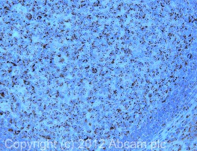 Immunohistochemistry (Formalin/PFA-fixed paraffin-embedded sections) - Anti-GC1q R antibody [60.11] - BSA and Azide free (AB238668), expandable thumbnail