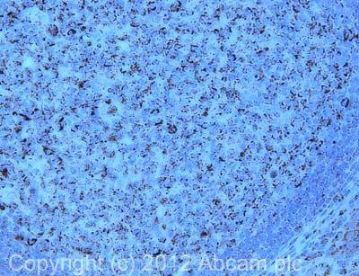 Immunohistochemistry (Formalin/PFA-fixed paraffin-embedded sections) - Anti-GC1q R antibody [60.11] - BSA and Azide free (AB238668)