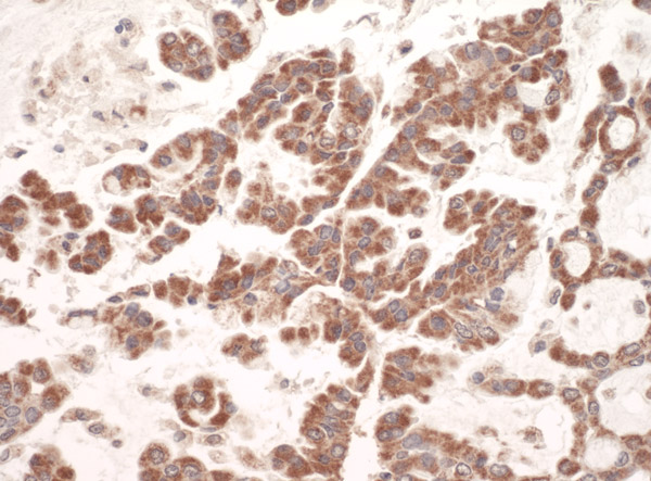 Immunohistochemistry (Formalin/PFA-fixed paraffin-embedded sections) - Anti-GC1q R antibody (AB101267), expandable thumbnail