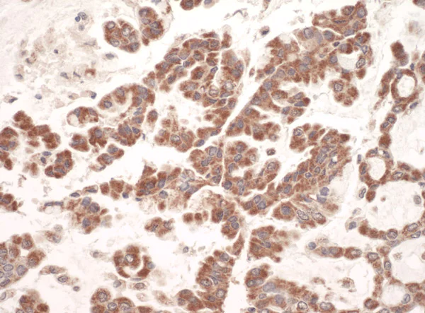 Immunohistochemistry (Formalin/PFA-fixed paraffin-embedded sections) - Anti-GC1q R antibody (AB101267)