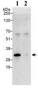 Immunoprecipitation - Anti-GC1q R antibody (AB101267), expandable thumbnail