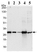 Western blot - Anti-GC1q R antibody (AB101267), expandable thumbnail