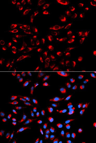 Immunocytochemistry/ Immunofluorescence - Anti-GC1q R antibody (AB180756), expandable thumbnail