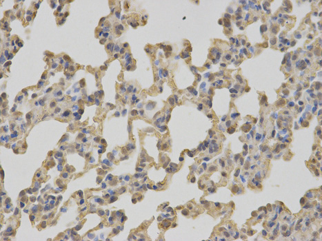 Immunohistochemistry (Formalin/PFA-fixed paraffin-embedded sections) - Anti-GC1q R antibody (AB180756), expandable thumbnail