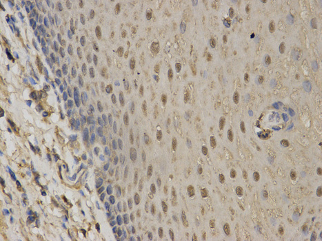 Immunohistochemistry (Formalin/PFA-fixed paraffin-embedded sections) - Anti-GC1q R antibody (AB180756), expandable thumbnail