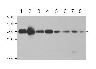 Western blot - Anti-GC1q R antibody (AB180756), expandable thumbnail