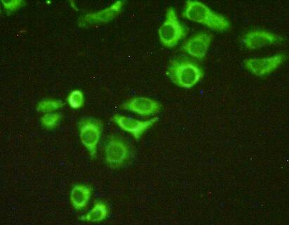 Immunocytochemistry/ Immunofluorescence - Anti-GC1q R antibody (ab232712), expandable thumbnail