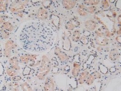 Immunohistochemistry (Formalin/PFA-fixed paraffin-embedded sections) - Anti-GC1q R antibody (AB232712), expandable thumbnail